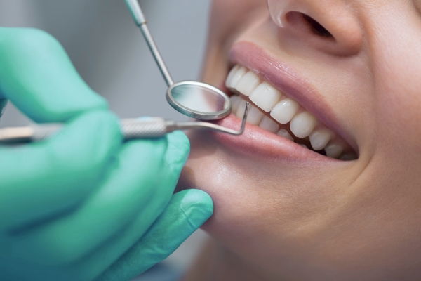 Servicio de Odontología general en Margarita - KOi Dental
